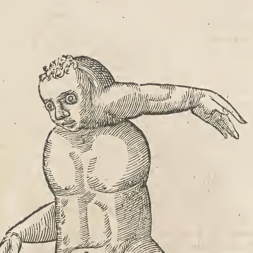 bambino con braccio collocato sul collo